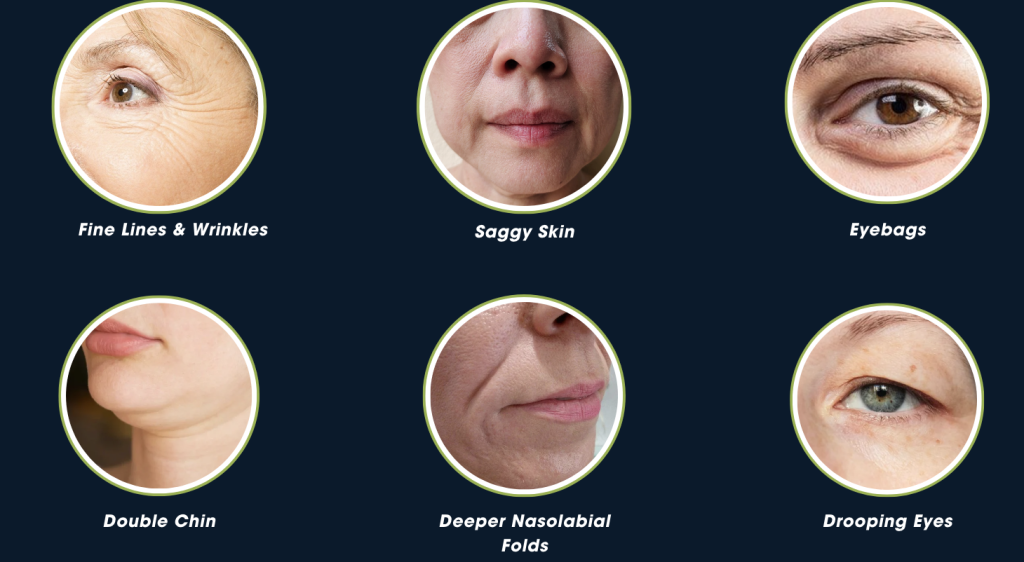 Signs of Aging and Saggy skin
